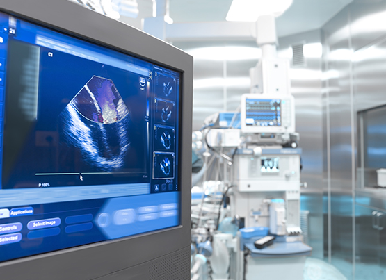 cardiac ultrasounf monitor